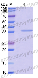 Recombinant Human WDR18 Protein, N-His