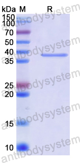 Recombinant Human WSB1 Protein, N-His