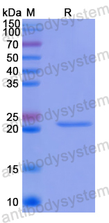 Recombinant Human SPRY4 Protein, N-His-SUMO
