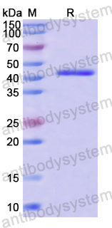 Recombinant Human ARMC8 Protein, N-His