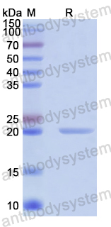 Recombinant Human ZHX1 Protein, N-His-SUMO