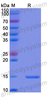 Recombinant Human ZNF410 Protein, N-His
