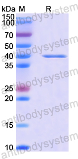 Recombinant Human SAMM50 Protein, N-His