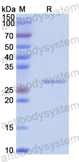 Recombinant Human SENP1 Protein, N-His