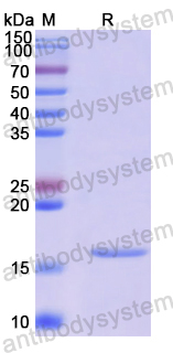 Recombinant Human ARFGAP1 Protein, N-His