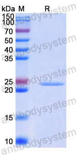 Recombinant Human ASH2L Protein, N-His