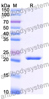 Recombinant Human KIAA0319L/AAVR Protein, N-His