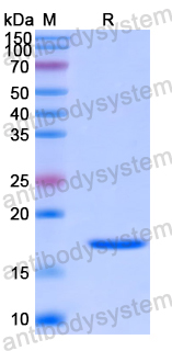 Recombinant Human RAD51AP1 Protein, N-His-SUMO