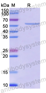 Recombinant Human CCT7 Protein, N-His