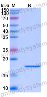 Recombinant Human THRSP Protein, N-His