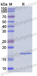 Recombinant Human TTC7A Protein, N-His