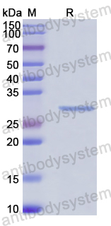 Recombinant Human SRP68 Protein, N-His
