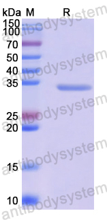 Recombinant Human STRAP Protein, N-His