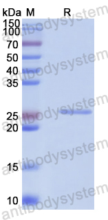 Recombinant Human TBX5 Protein, N-His