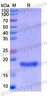Recombinant Human TRAPPC9 Protein, N-His
