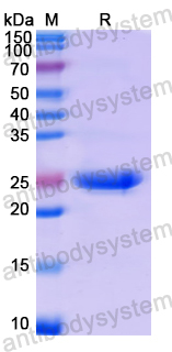 Recombinant Human TWIST2 Protein, N-His-SUMO & C-Strep