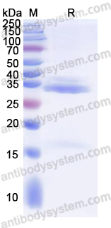 Recombinant Human VDAC3 Protein, N-His