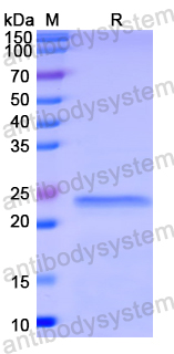 Recombinant Human SLC30A6 Protein, N-His-SUMO & C-Strep