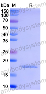Recombinant Human ARL2BP Protein, N-His