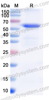 Recombinant Human BCO2 Protein, N-His