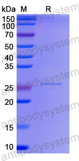 Recombinant Human CHMP7 Protein, N-His