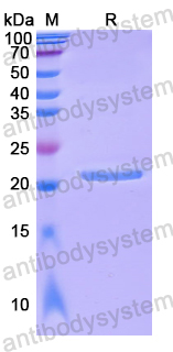 Recombinant Human DCTN5 Protein, N-His