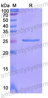 Recombinant Human DDX20 Protein, N-His
