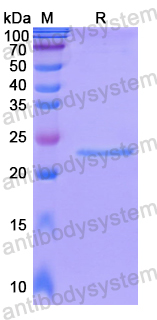 Recombinant Human DIABLO Protein, N-His