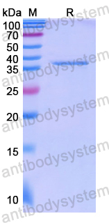 Recombinant Human PARVB Protein, N-His