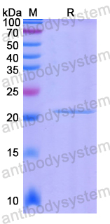 Recombinant Human PIK3R5 Protein, N-His