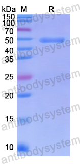 Recombinant Human PIP5K1A Protein, N-His
