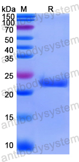 Recombinant Human RAB1B Protein, N-His