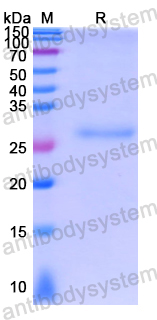 Recombinant Human RDM1 Protein, N-His
