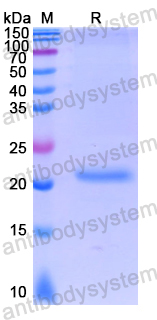 Recombinant Human RNF20 Protein, N-His-SUMO & C-Strep