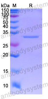 Recombinant Human SNRPB2 Protein, N-His