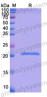 Recombinant Human SNX5 Protein, N-His