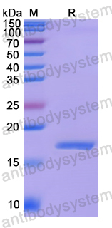 Recombinant Human SELENON Protein, N-His