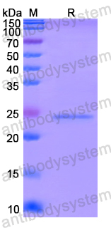 Recombinant Human HPS5 Protein, N-His-SUMO & C-Strep