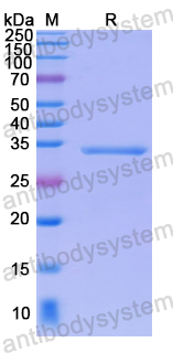 Recombinant Human STK26 Protein, N-His