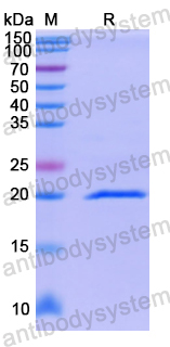 Recombinant Human NDOR1 Protein, N-His