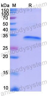 Recombinant Human NDRG1 Protein, N-His
