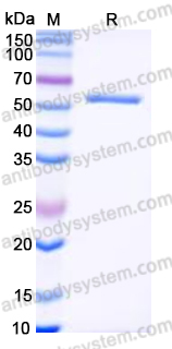 Recombinant Human NDRG1 Protein, N-His
