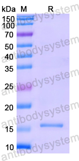 Recombinant Human PHF11 Protein, N-His