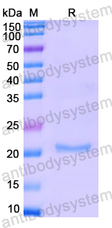 Recombinant Human PIH1D1 Protein, N-His