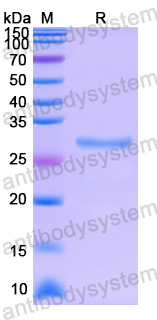 Recombinant Human PIKFYVE Protein, N-His