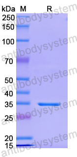 Recombinant Human PRICKLE1 Protein, N-His