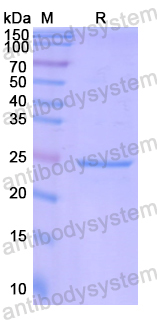 Recombinant Human ARHGEF1 Protein, N-His