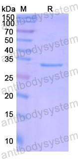 Recombinant Human ARMCX3 Protein, N-His