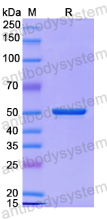 Recombinant Human ERAP1 Protein, N-His