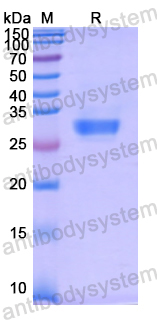 Recombinant Human ASB9 Protein, N-His